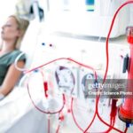 Dialysis